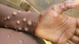Casos de varíola de macaco preocupa autoridades mundiais; veja como se proteger