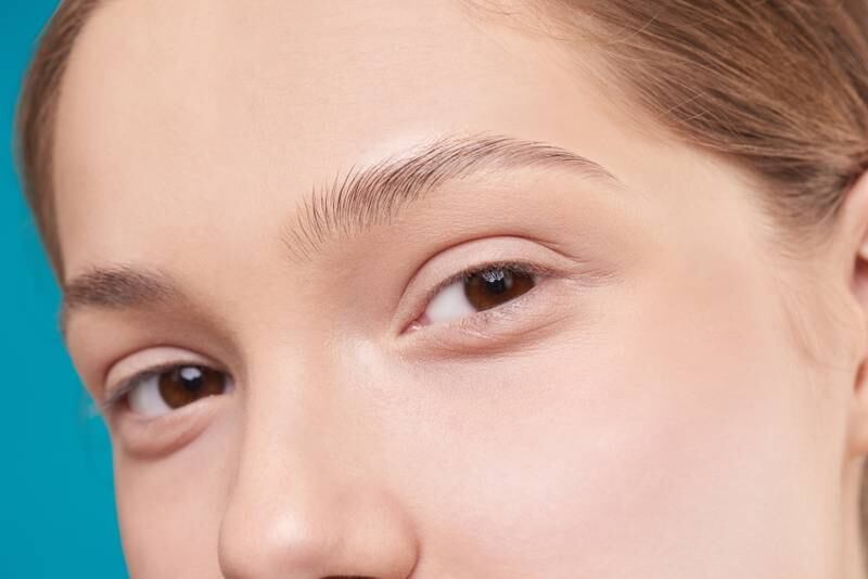 Olheiras: esta é a dica definitiva para amenizar as manchas escuras nos olhos