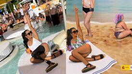 Espanha edita foto de modelo com perna mecânica para promover ação de positividade dos corpos