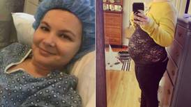 Ela não está grávida: mulher que não pode ter filhos precisa explicar a causa do abdômen inchado 