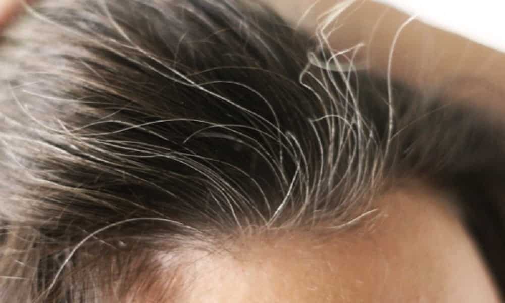 Como escurecer o cabelo sem tintura? Use 3 ingredientes da cozinha para cobrir cabelos grisalhos